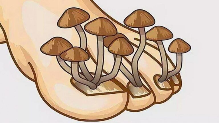 Questo semplice gesto può eliminare il tuo problema di funghi in una settimana…
