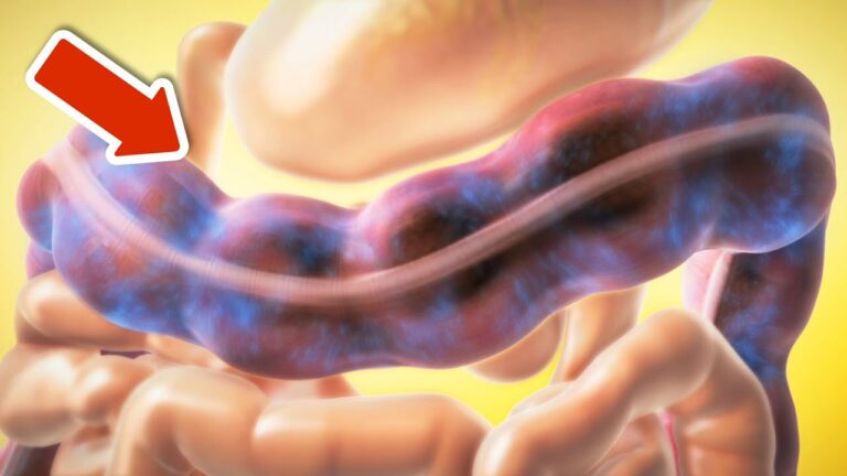 7 rimedi naturali per pulire il tuo stomaco e intestino in modo efficace!