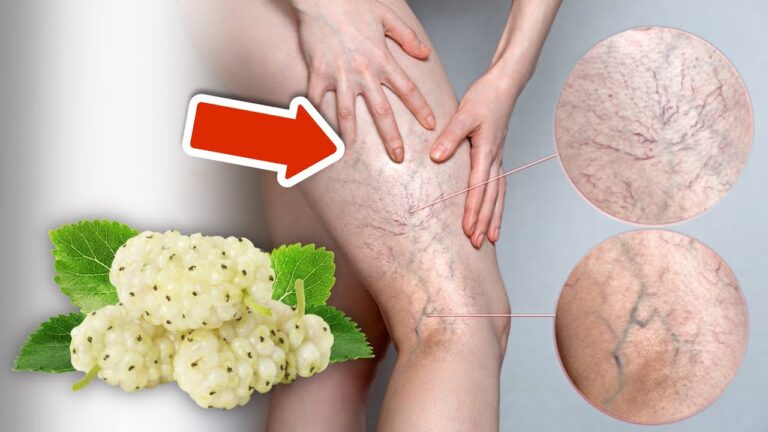 Scopri 5 frutti che aiutano a ridurre le varici in modo sorprendente!