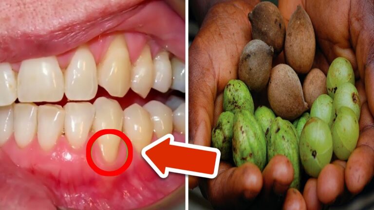 3 frutti che risolvono i problemi di denti e gengive in modo geniale!