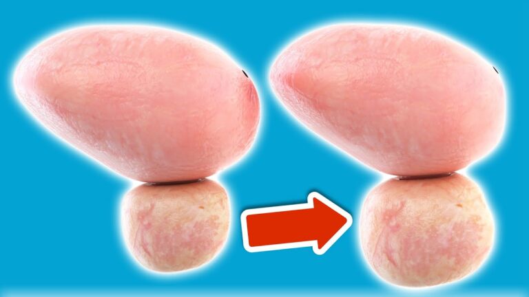 7 segni che indicano una prostata ingrossata da non ignorare!