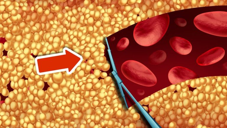 8 modi naturali per abbassare il colesterolo e migliorare la salute!